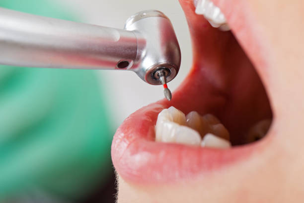 Best Dentist for Tooth Abscess  in Brimfield, OH